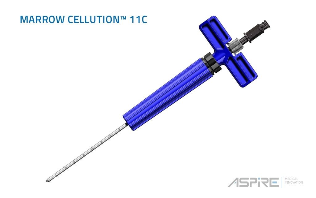 Marrow Cellution bone marrow stem cell aspiration system